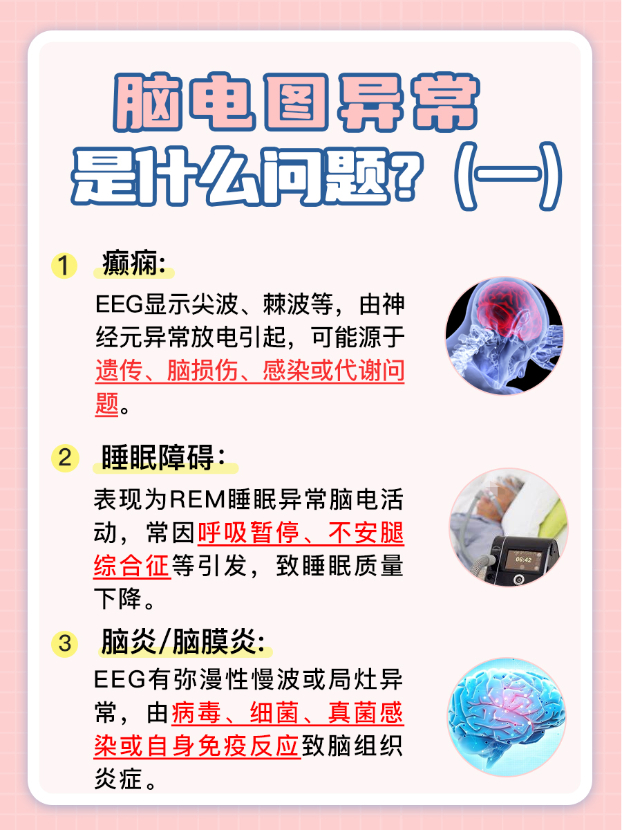 医生提醒：脑电图异常？快来了解可能是什么问题