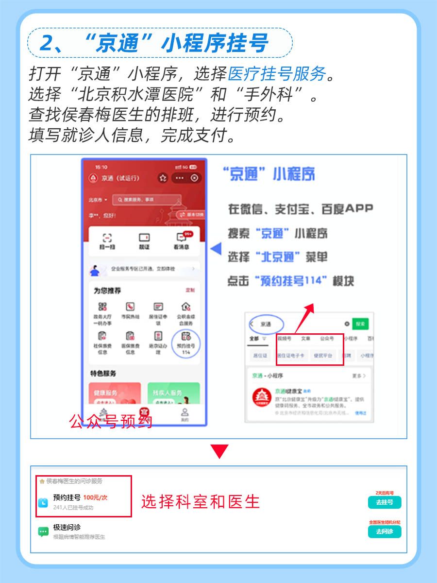 北京积水潭医院侯春梅医生怎么样？怎么挂号？
