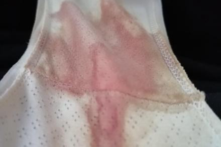 德华新婚之夜为什么见红为什么在线