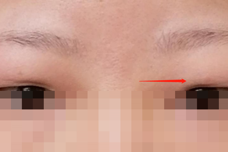 眼泡部位图 眼泡部位图