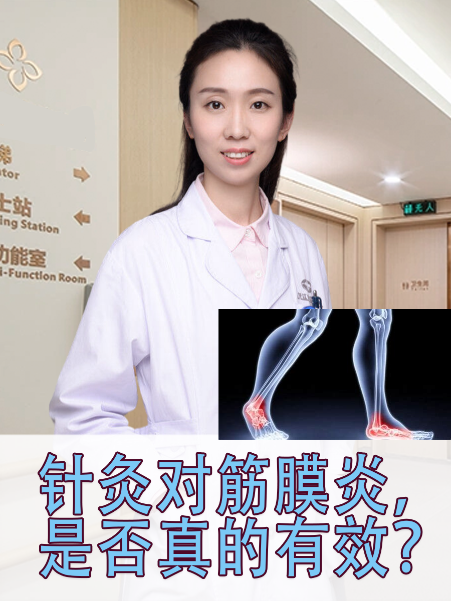 针灸对筋膜炎，是否真的有效？