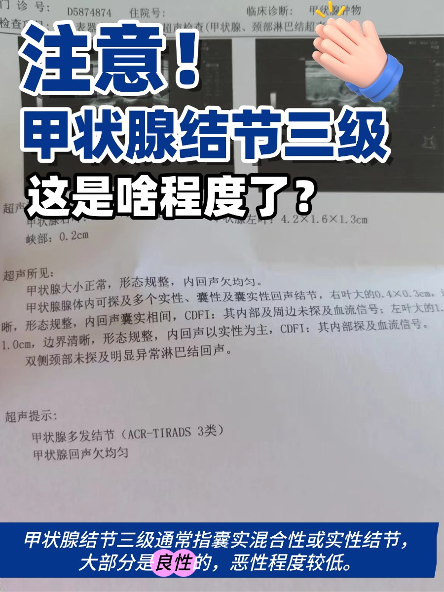 注意!甲状腺结节三级,这是啥程度了?
