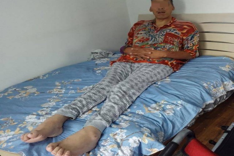 巨人症全身变形图