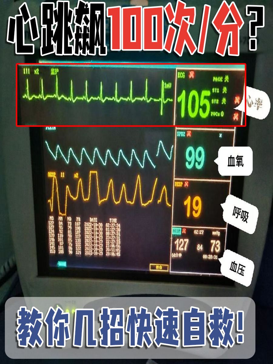 心跳飙100次/分？教你几招快速自救！