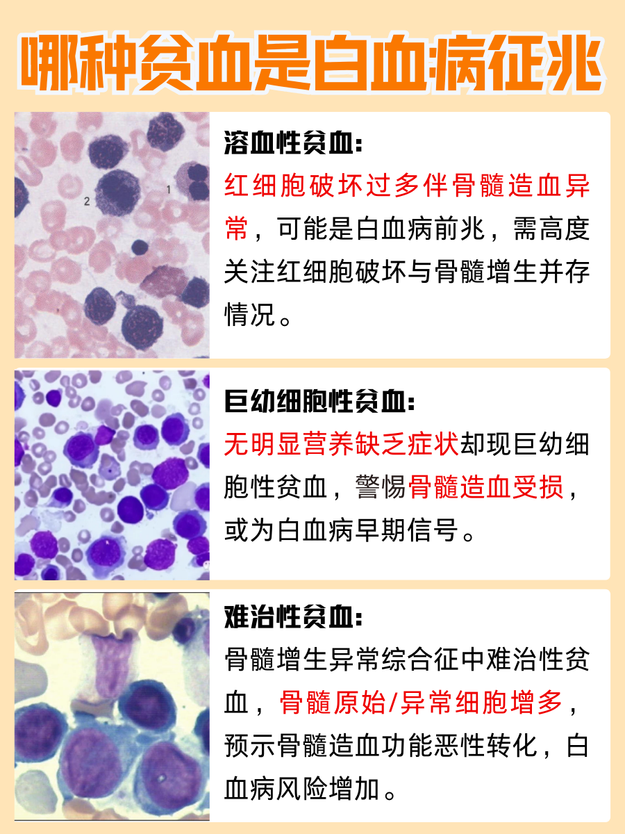 白血病征兆?这几种贫血不容小看!