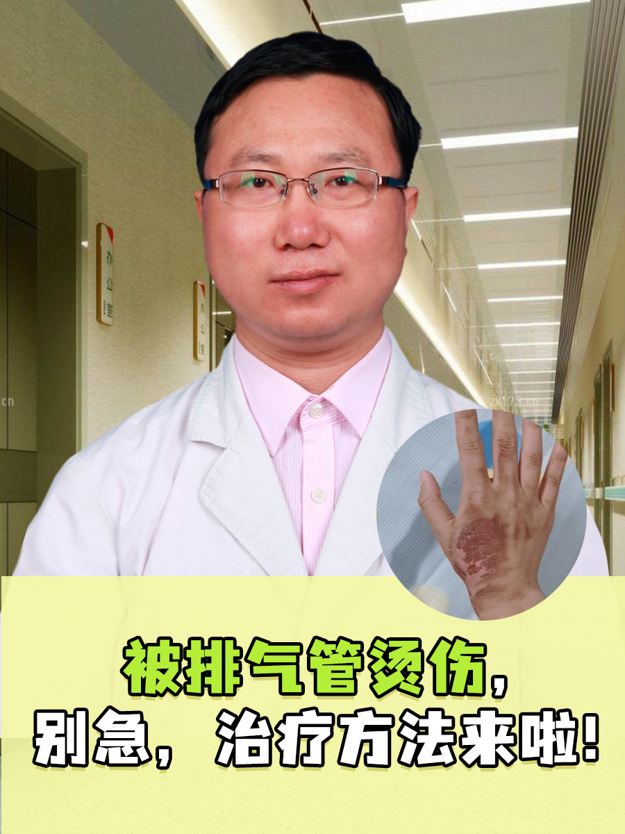 被排气管烫伤,别急,治疗方法来啦!