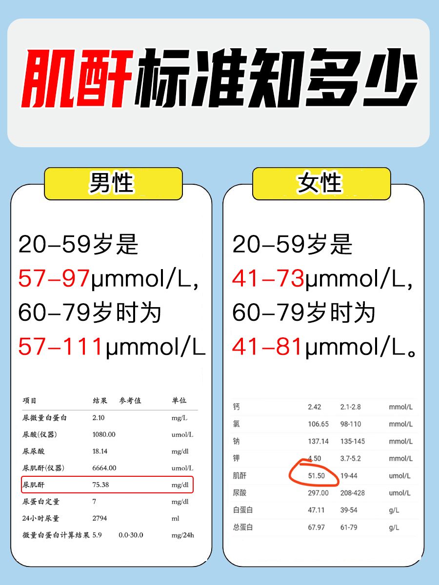 60-70岁的肌酐标准，你都知道吗？