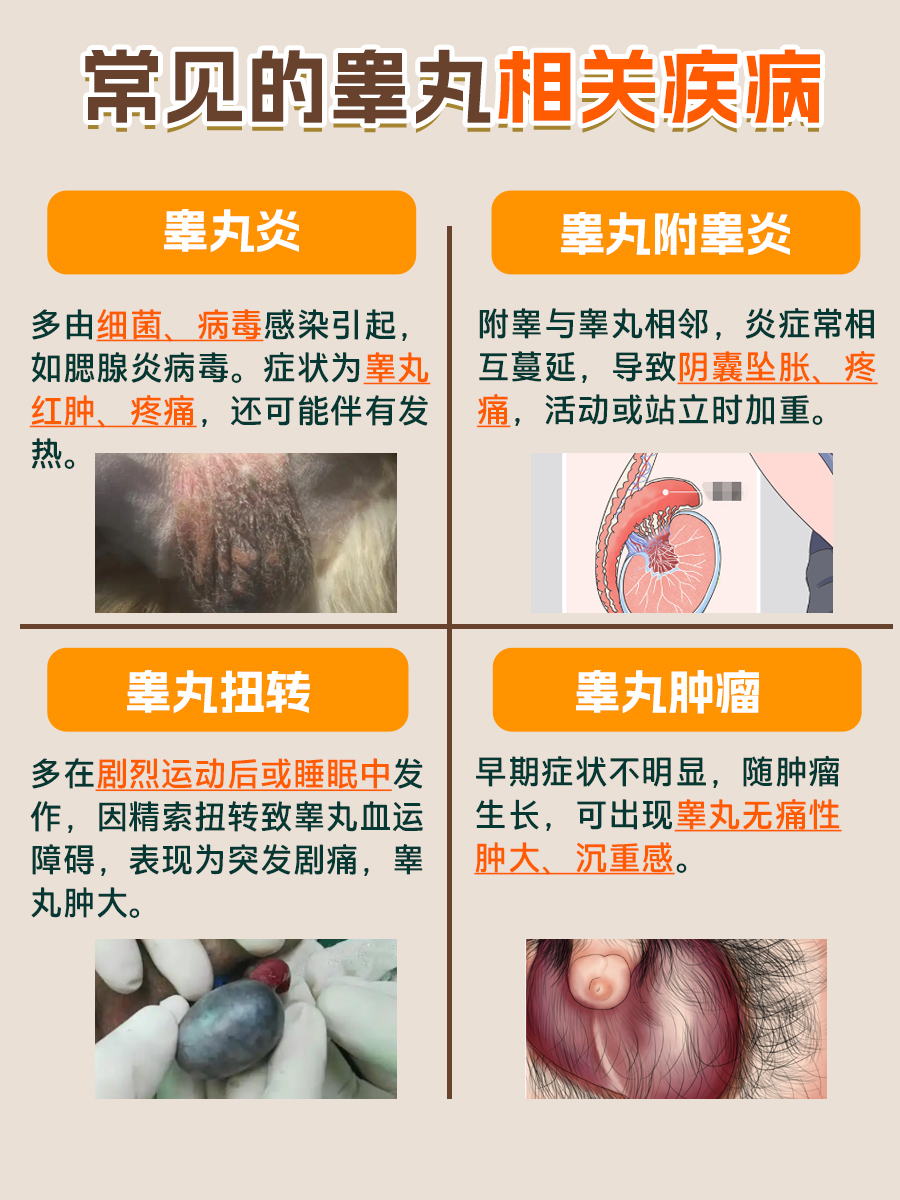 睾丸检查费用知多少?一篇文章带你了解全部!