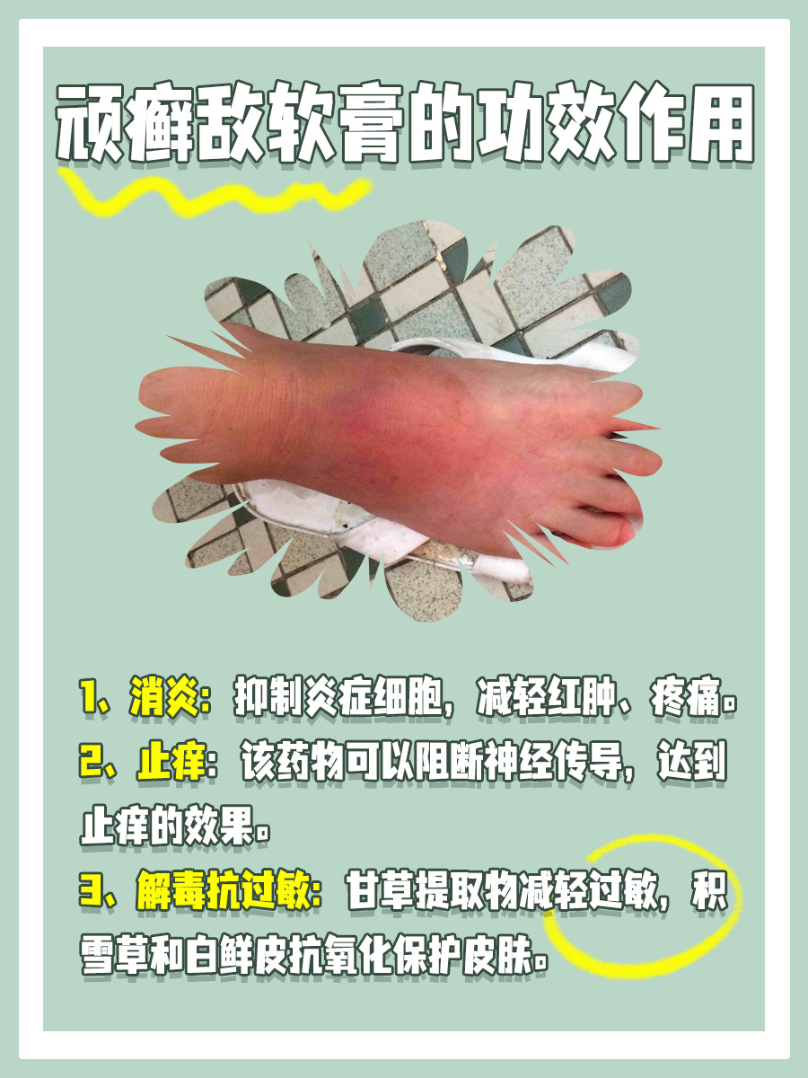 一文揭秘，顽癣敌软膏的功效作用！