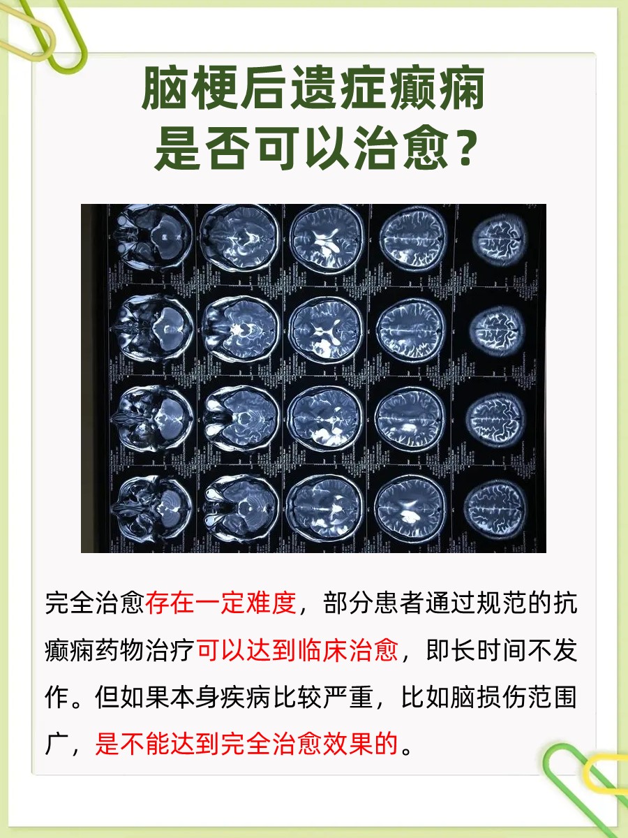脑梗后遗症癫痫病可以治愈吗？快来看答案解析