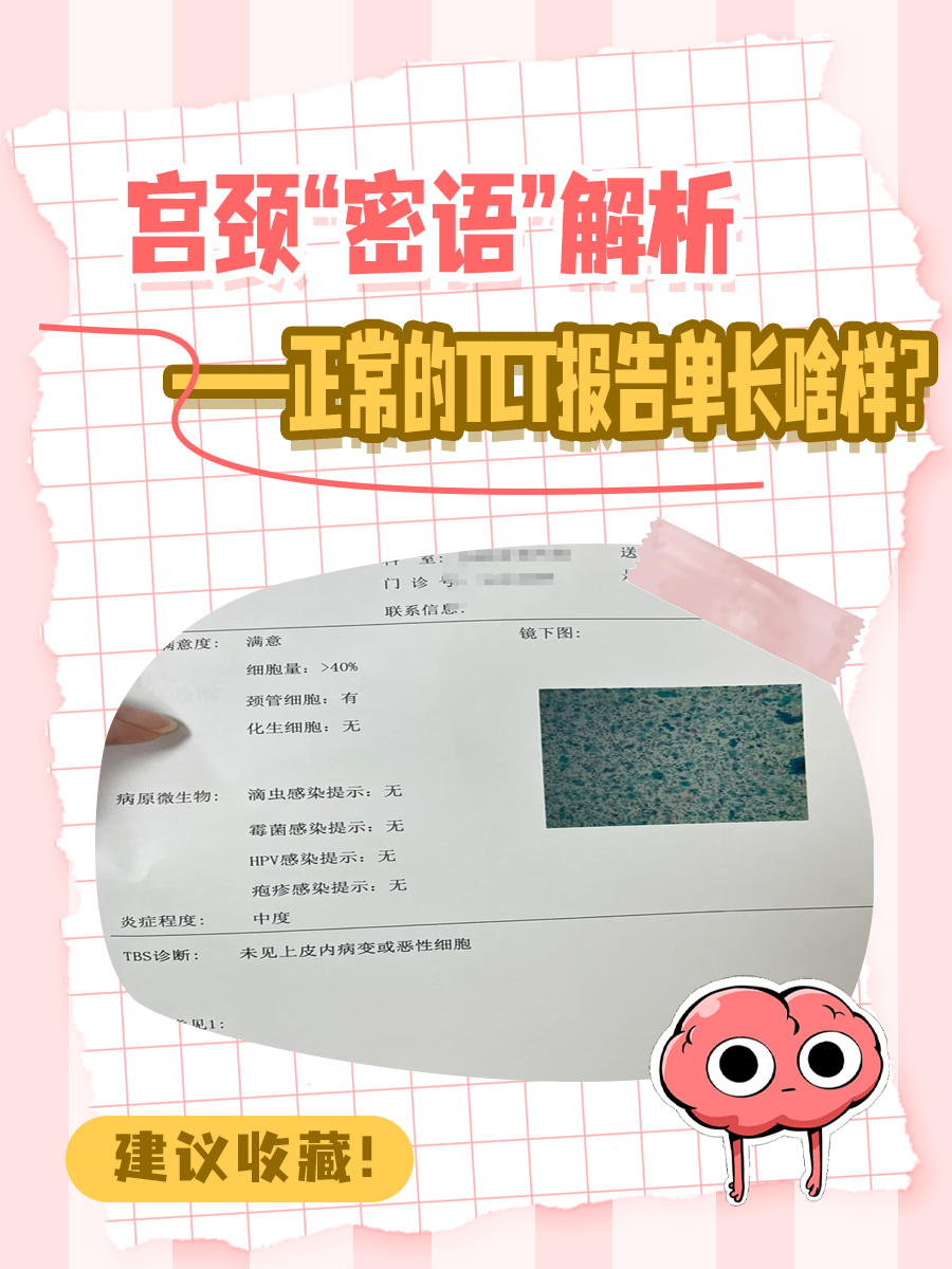 宫颈“密语”解析之正常的TCT报告单长啥样？