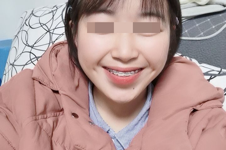 嘴角下面有两个窝图