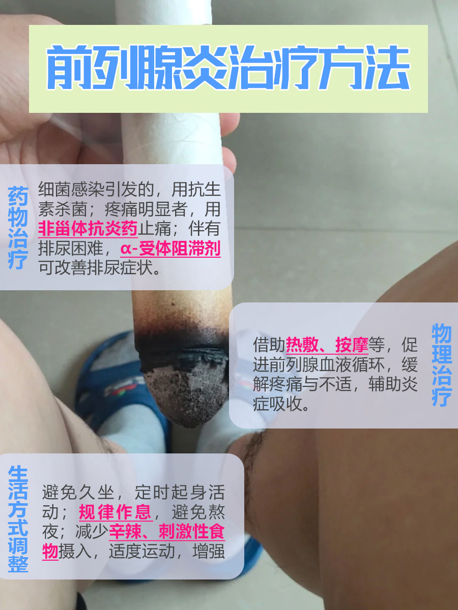 30秒自测前列腺炎可行吗?别被误导!