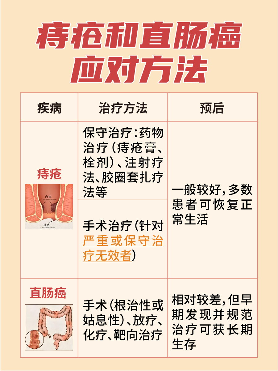 痔疮和直肠癌的区别,一文了解