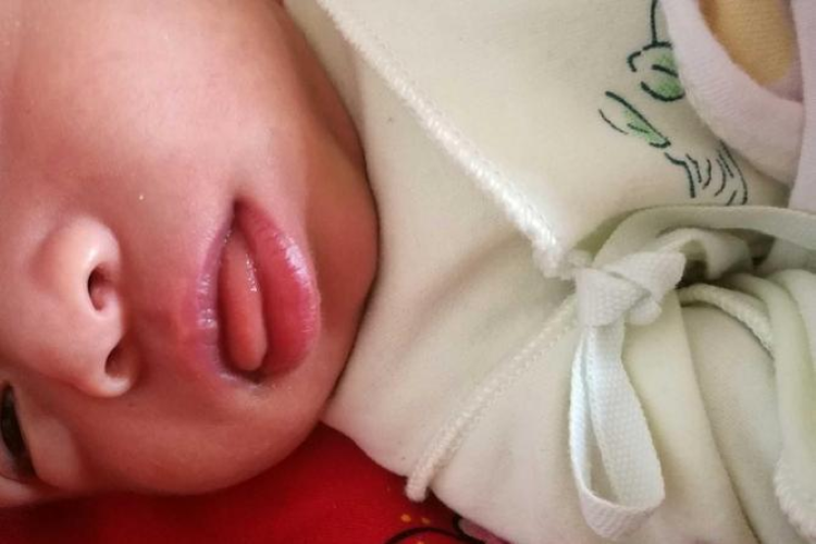 新生儿嘴唇正常颜色图