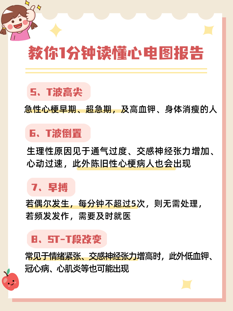 教你1分钟读懂心电图报告