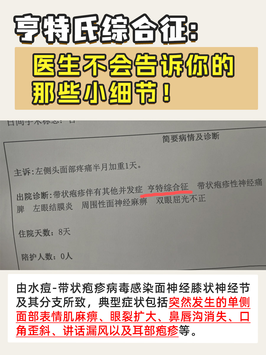 亨特氏综合征：医生不会告诉你的那些小细节！