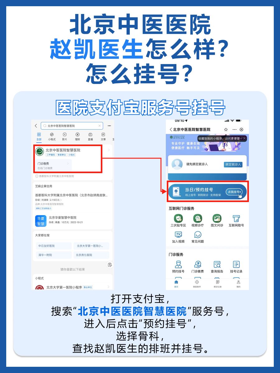 北京中医医院赵凯医生怎么样？怎么挂号？