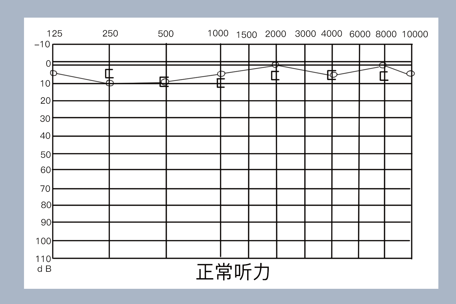 纯音测听正常值图