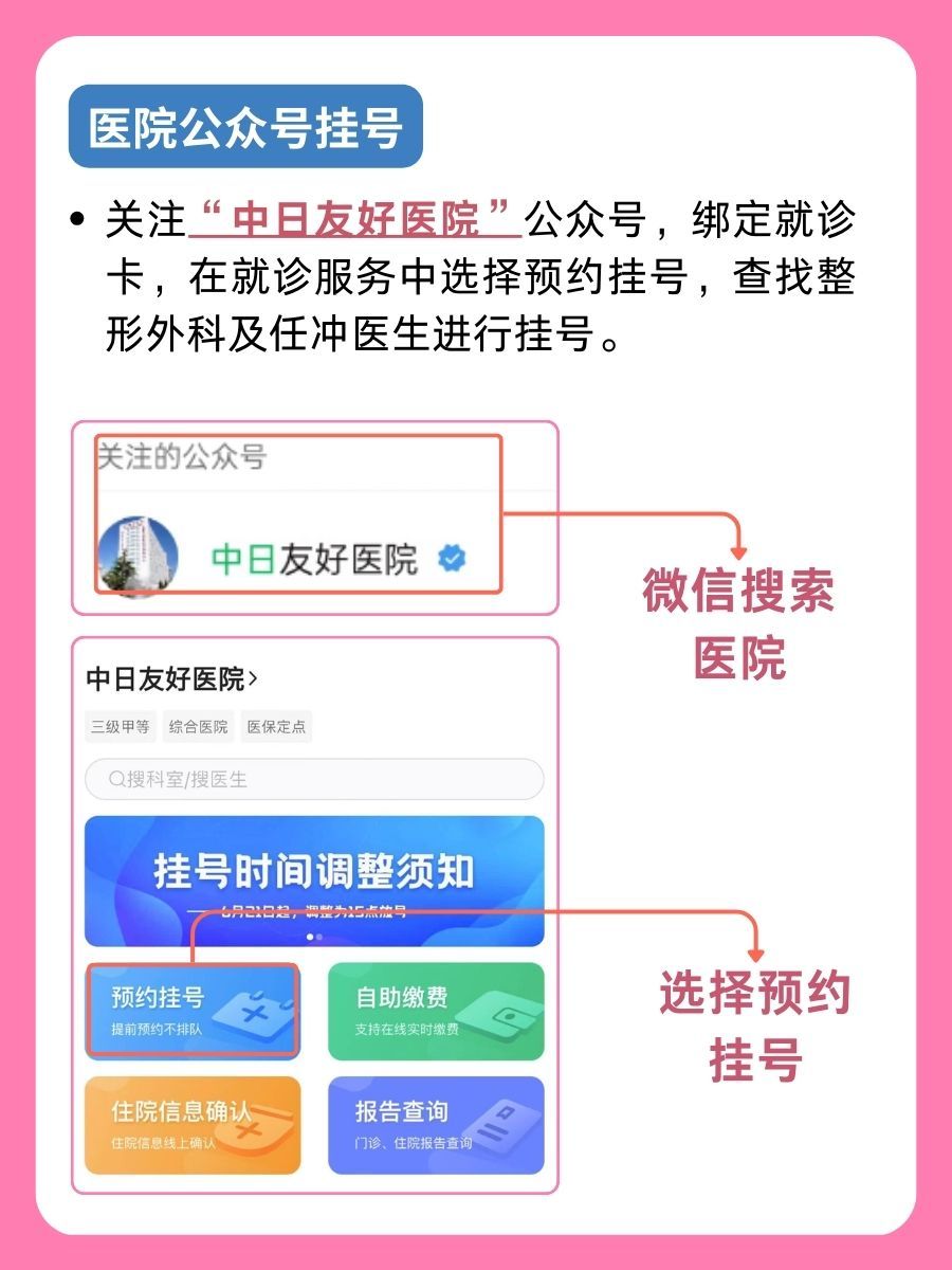 中日友好医院任冲医生怎么样？怎么挂号？