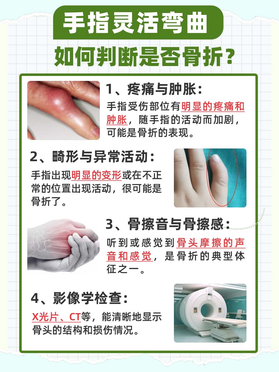 手指灵活弯曲,算骨折?揭秘隐藏的痛!