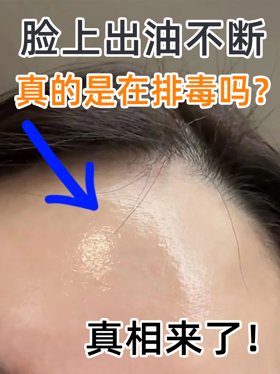 脸上出油不断，真的是在排毒吗？真相来了！