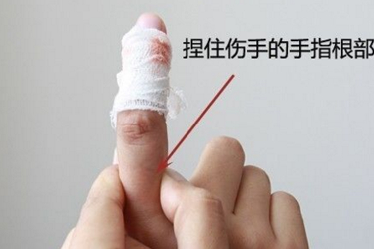 手指出血压迫指根两侧图