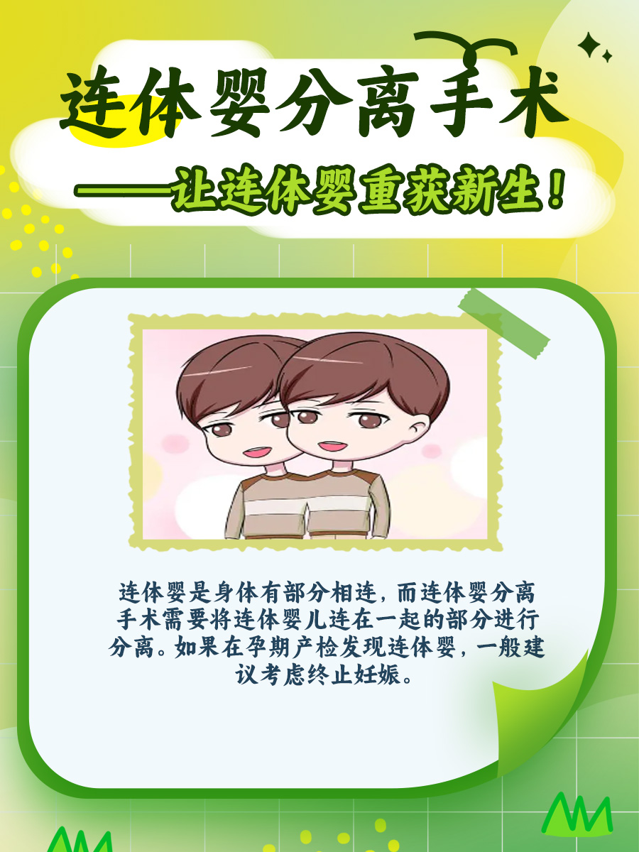 连体婴分离手术——让连体婴重获新生！