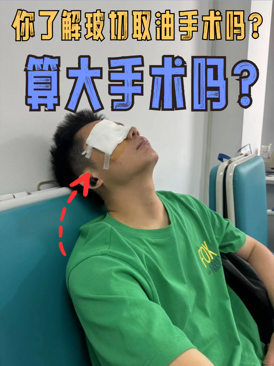 你了解玻切取油手术吗？算大手术吗？