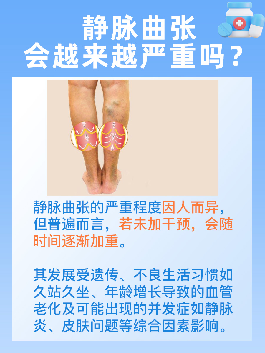 静脉曲张警钟！它会不断加重吗？必看解答！