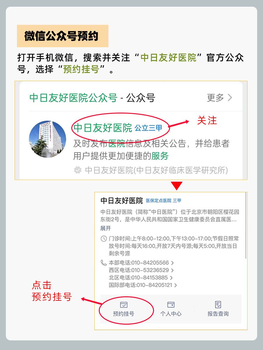 中日友好医院张丽雯医生怎么样？怎么挂号？