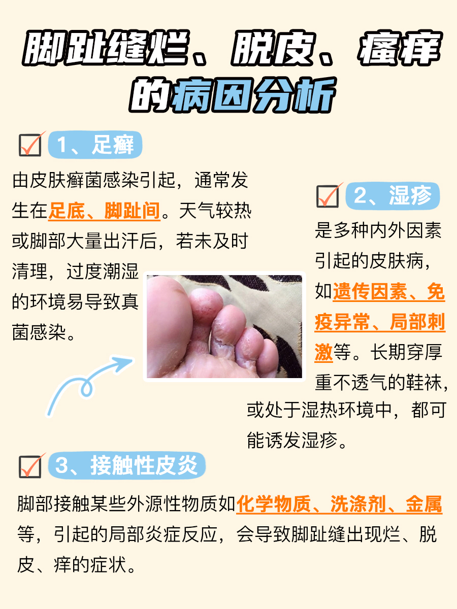 脚趾间秘密！烂、脱皮、痒？速速解决