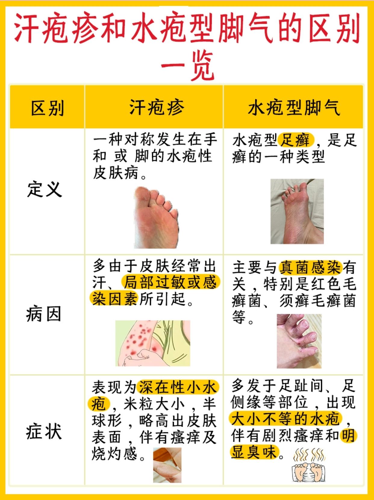 汗疱疹和水泡型脚气的区别,医生解答