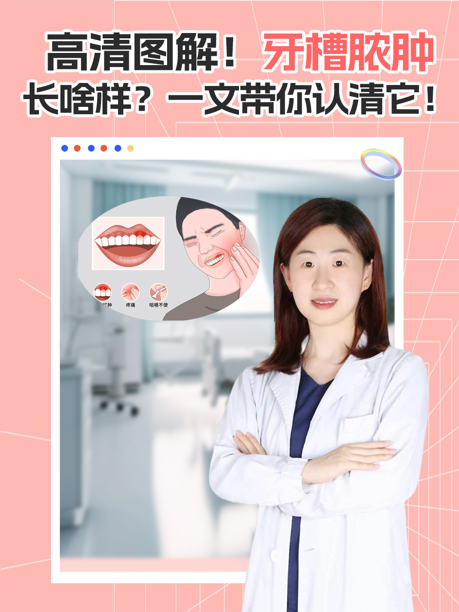 高清图解！牙槽脓肿长啥样？一文带你认清它！