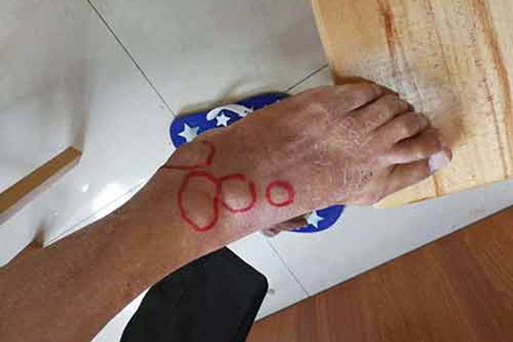 脚踝、足弓痛风图