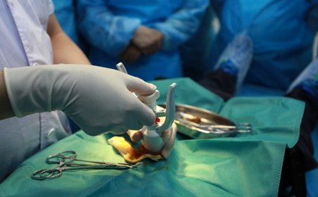 欧式包茎手术过程图片图片