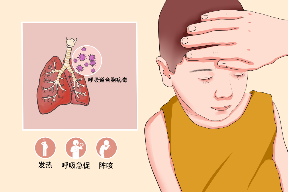 RSウイルスはどのように感染しますか?