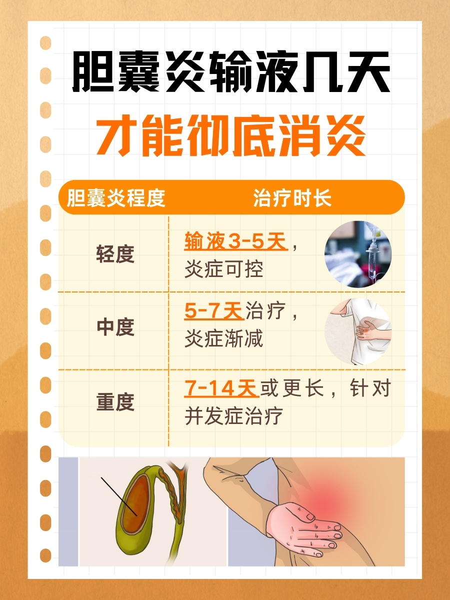 胆囊炎输液几天才能彻底消炎,一文解析