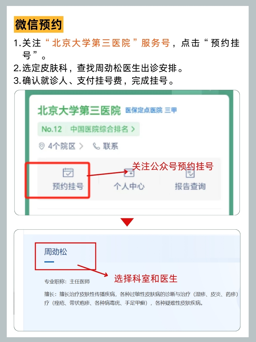北京大学第三医院周劲松医生怎么样?怎么挂号?