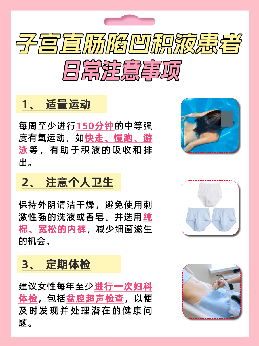 子宫直肠陷凹积液是怎么回事？你知道吗？