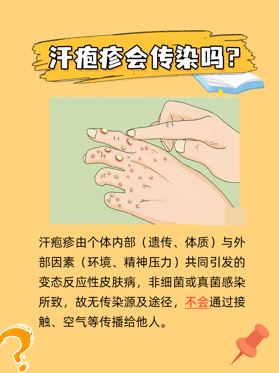 专家来给你科普一下：汗疱疹会传染吗？