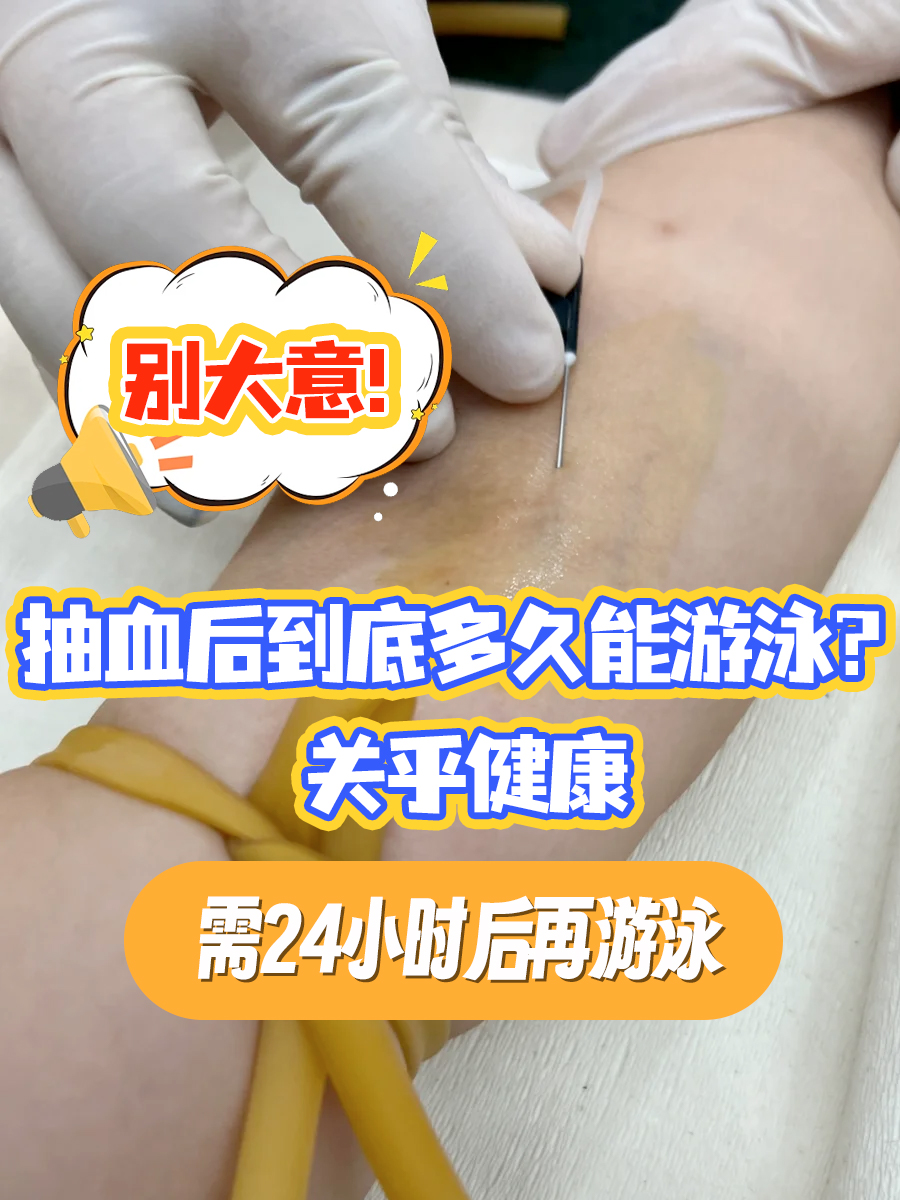 别大意！抽血后到底多久能游泳？关乎健康