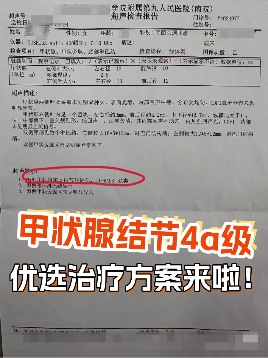 甲状腺结节4a级,优选治疗方案来啦!