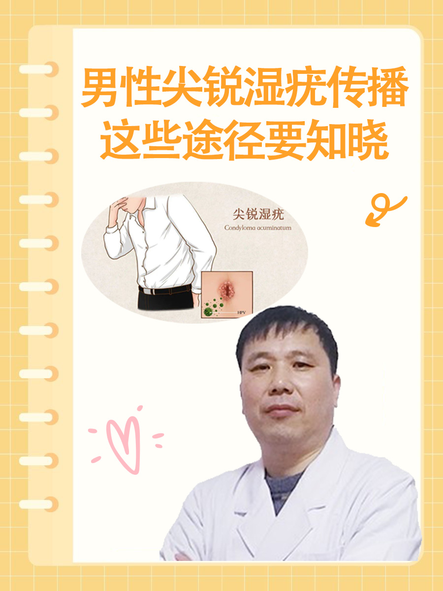 男性尖锐湿疣传播，这些途径要知晓