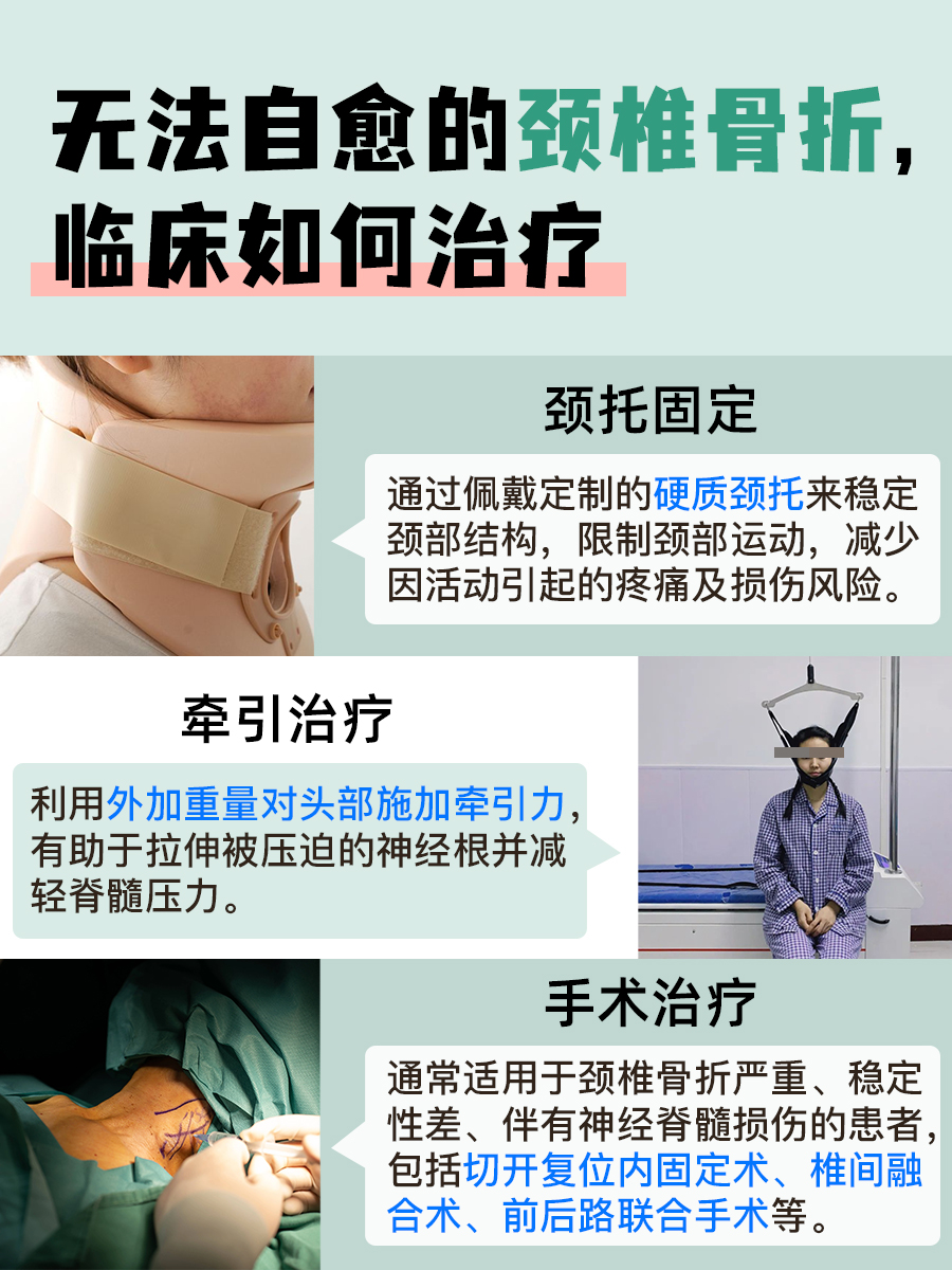 别再瞎猜了!颈椎骨折自愈时间一次说清楚