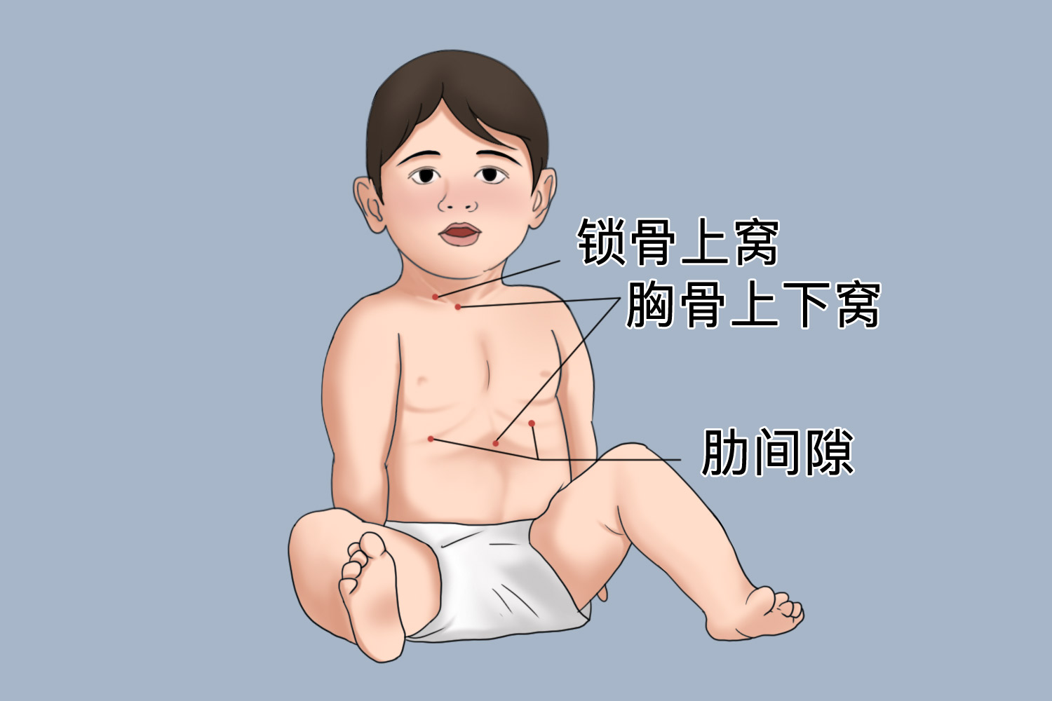 喉软化症三凹图 喉软化症三凹图