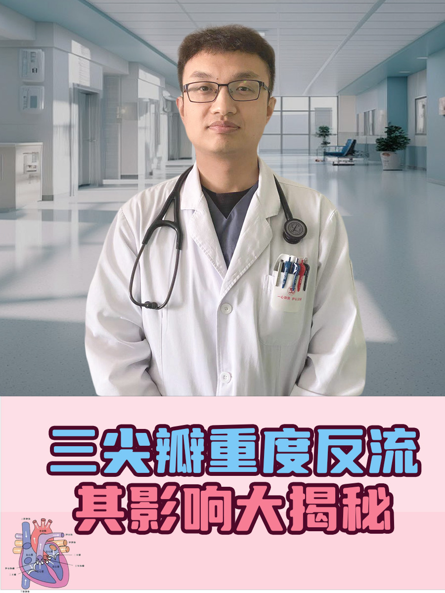 三尖瓣重度反流,其影响大揭秘