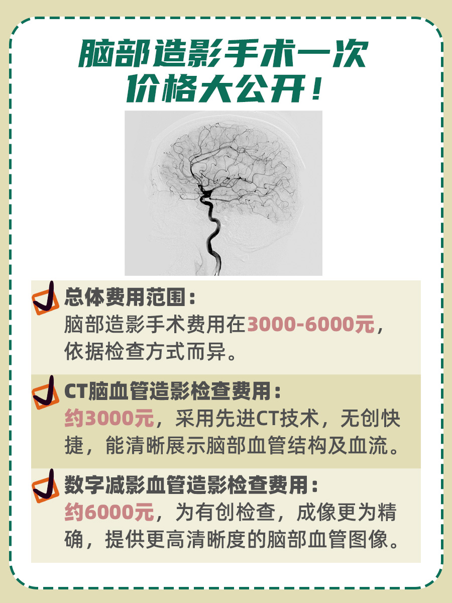 脑部造影手术费用:究竟多少钱一次?