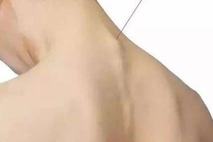 生理性脖子后面骨头凸起图