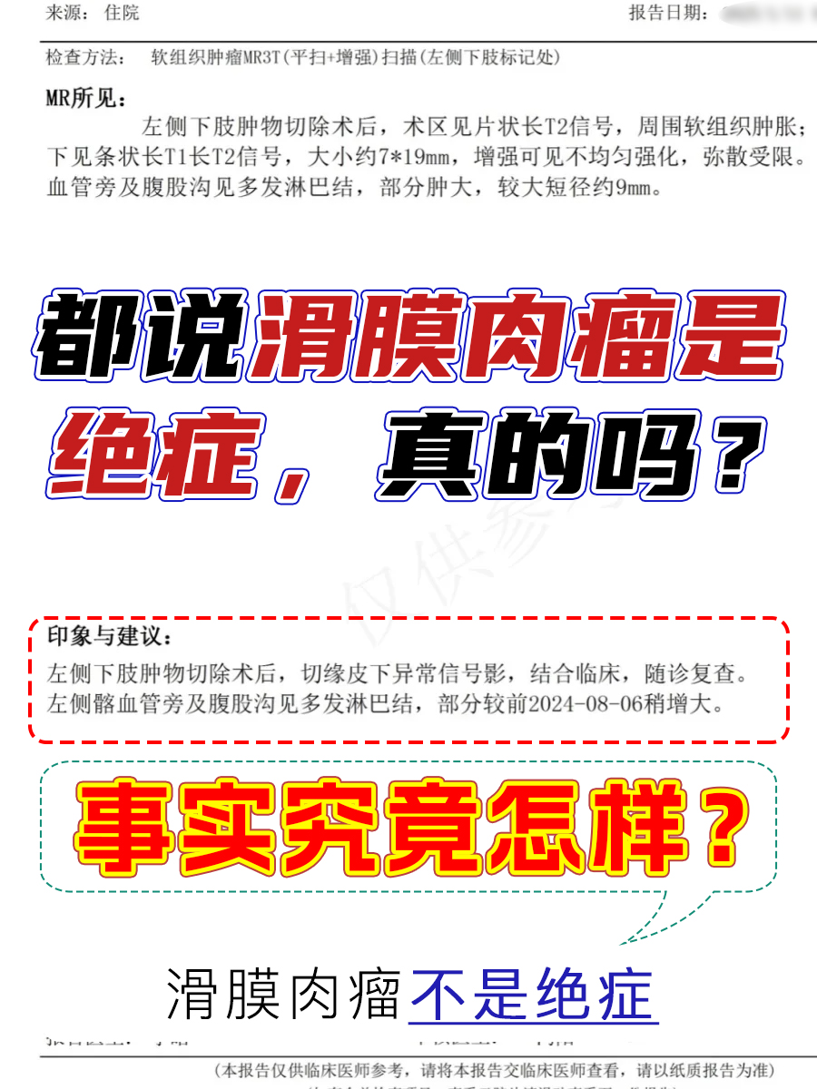 都说滑膜肉瘤是绝症，真的吗？事实究竟怎样？